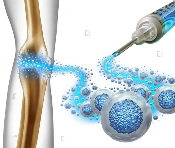 Role of Stem Cells in Treating Chronic Conditions